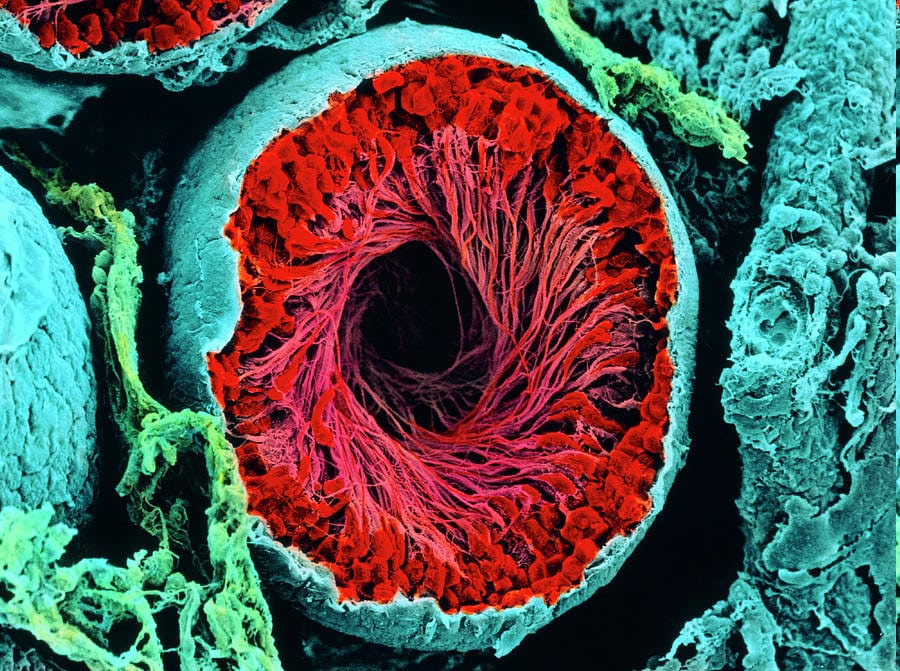Окрашенное изображение тканей яичка (сканирующий электронный микроскоп)