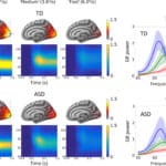 Недостаточная активность тормозных нейронов зрительной коры помешала детям с аутизмом определять направление движения мелких объектов