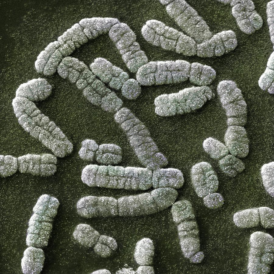 Человеческие хромосомы под сканирующим микроскопом