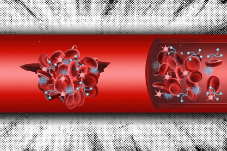 Наночастицы имитируют работу тромбоцитов, а полимер — белков, образуя искусственный тромб