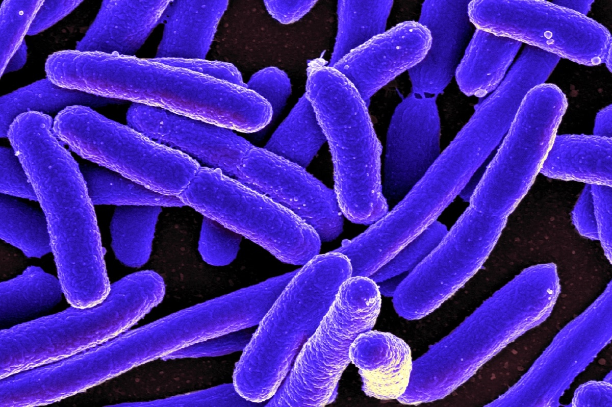 Кишечная палочка E coli