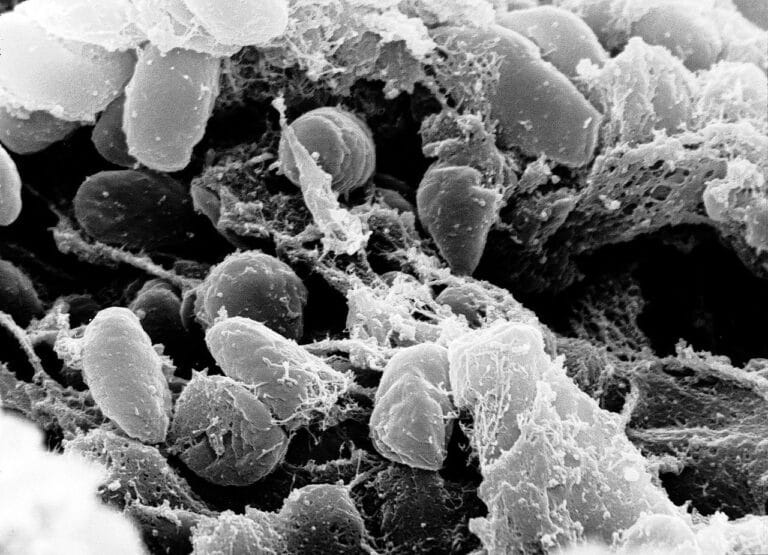 Yersinia pestis, электронная микрофотография / © Wikipedia