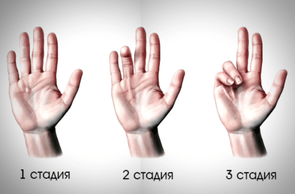 рука