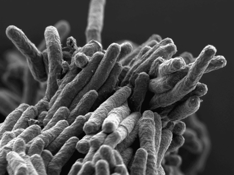 Палочка Коха под микроскопом