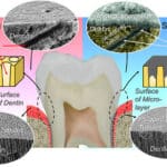 Медики нашли вкусный способ снижения чувствительности зубов