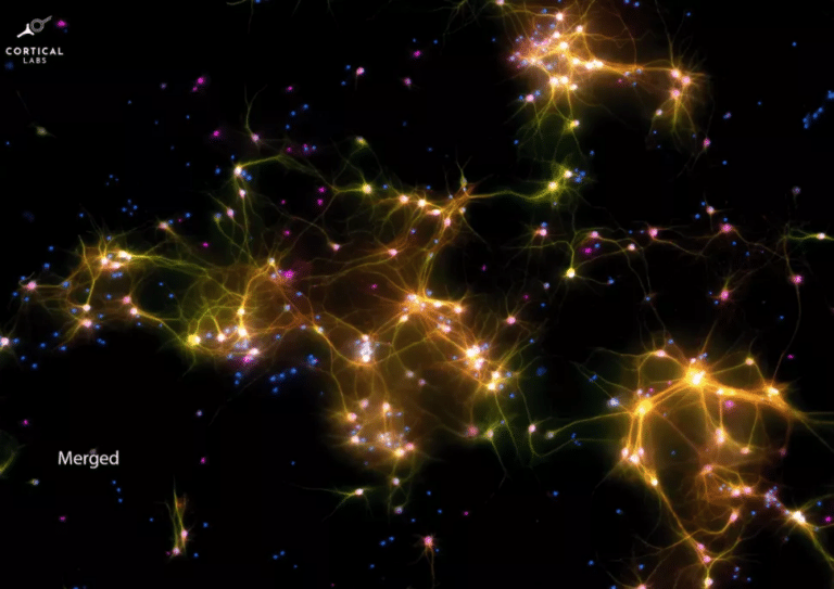 Микроскопическое изображение нейронов в DishBrain с клетками / © Cortical Labs