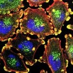 Раковые клетки научили производить токсин, от которого они гибнут