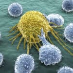 Суперклетки-убийцы помогли победить рак на конечной стадии