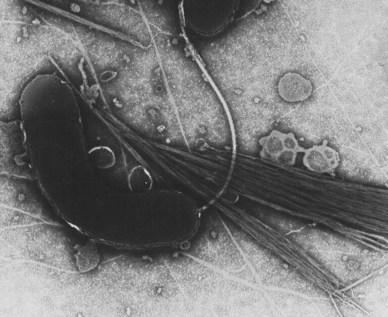 Холера — особо опасное инфекционное заболевание, возбудителем которого выступает холерный вибрион (Vibriocholerae) / © Wikipedia
