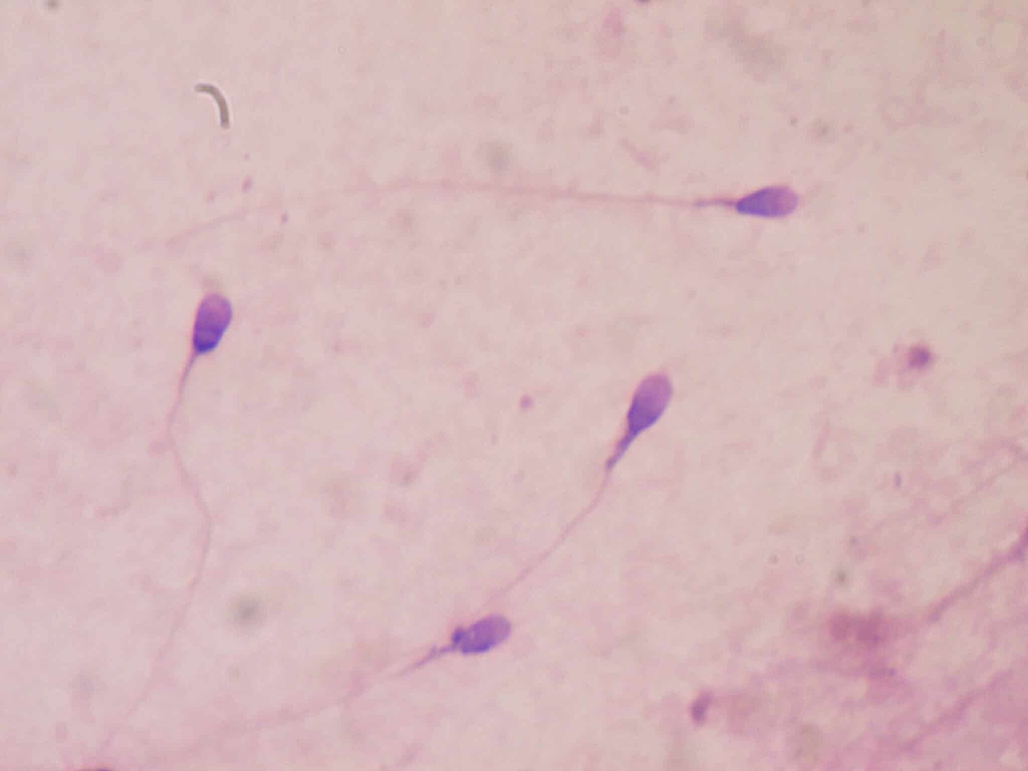 Ученые объяснили падение качества спермы
