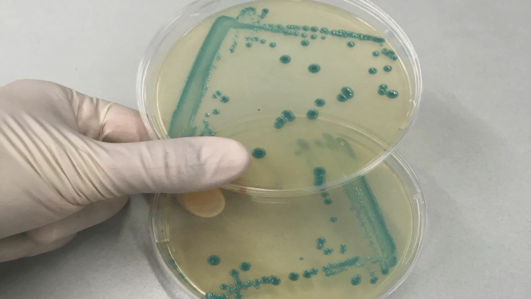 Штаммы бактерий / © artembolnica