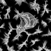 Разрушенная клетка грибка Candida на поверхности из «наношипов»: увеличение в 25 тысяч раз