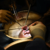 Сердце свиньи во время операции