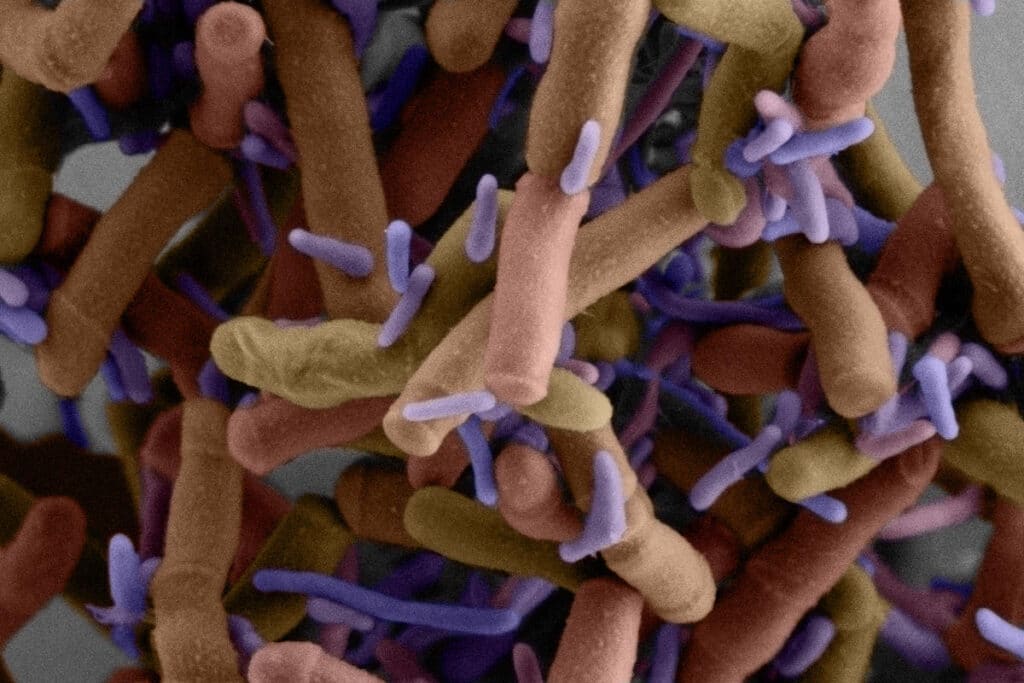 Patescibacteria