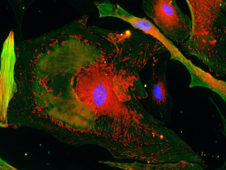 Микрофотография клеток соединительной ткани человека, дифференцировка которых меняется под влиянием внеклеточных везикул, секретированных клетками с отредактированными генами микроРНК / Наталия Басалова