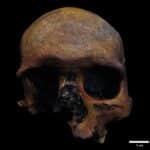 В черепе мужчины, жившего 1600 лет назад, обнаружили следы менингиомы