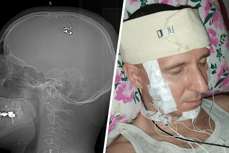 Михаил Радуга после операции / © Michael Raduga / Twitter 