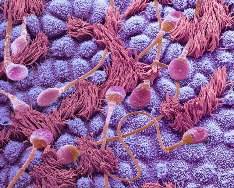 Сперматозоиды в фаллопиевых трубах