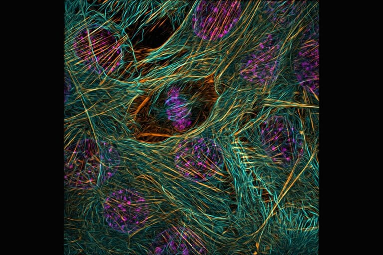Цитоскелет делящейся клетки-миобласта / © Vaibhav Deshmukh