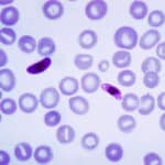 Происхождение малярии