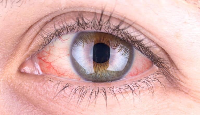 В МТУСИ внедрили метод глубокого обучения для сегментации капилляров глаза