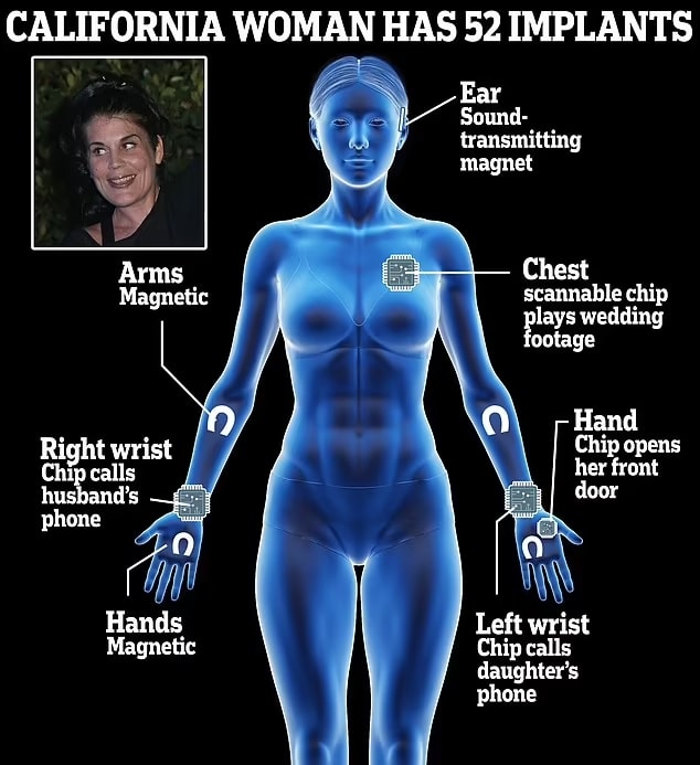 Анастейша Синн и ее имплантаты / © Daily Mail