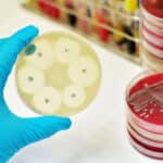 Устойчивость патогенов к антибиотикам связали с нехваткой витаминов