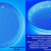 Панцири микроскопических водорослей вдохновили создание ультразвуковых медицинских датчиков