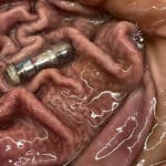 Инженеры изобрели вибрирующую «таблетку», обманывающую желудок 