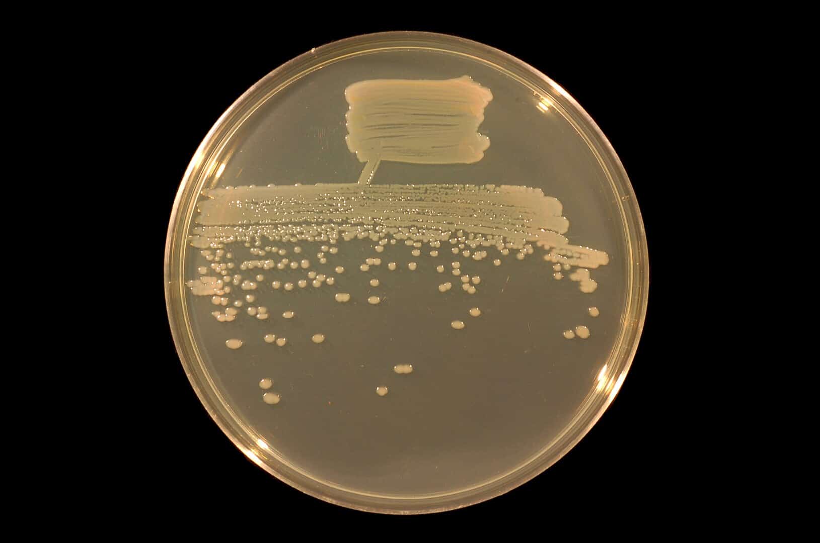 2 бактерии 1 8. Pseudomonas Fluorescens колония. Колония бактерий Pseudomonas Fluorescens. Pseudomonas Fluorescens препараты. Бактерии рода Pseudomonas.