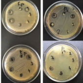 Фото чашек с результатами одного из экспериментов по определению антибактериального действия растворов