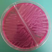 Бактерии Salmonella Typhi