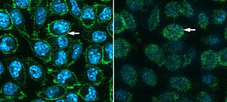 Человеческие белки ACE2, экспрессируемые на клетках мышей после инкубации клеток с флуоресцентно меченым белком-шипом SARS-CoV-2. Слева: вид через середину клеток со стрелкой, указывающей на клеточную мембрану. Справа: вид поверхности мембраны снаружи клеток. Синяя флуоресценция соответствует ДНК в ядрах клеток / © Брукхейвенская национальная лаборатория