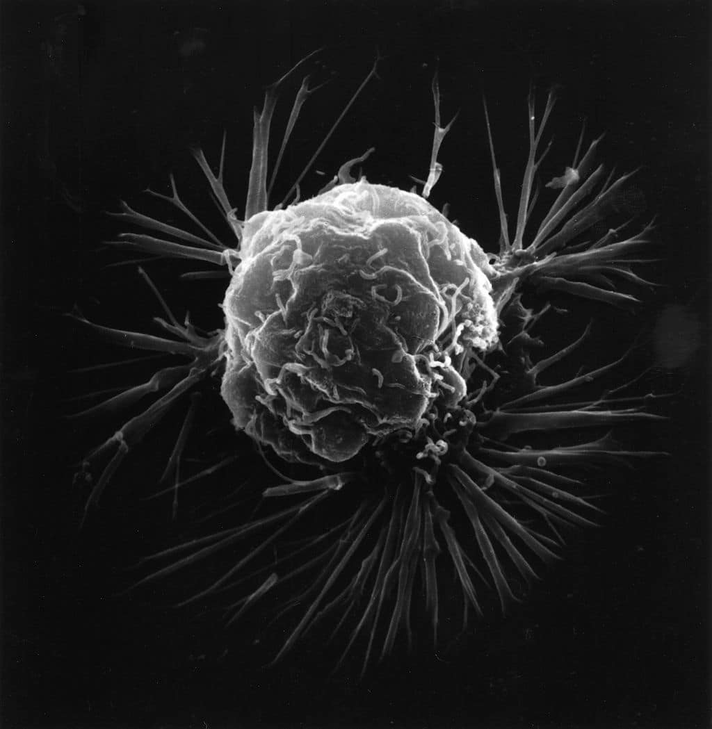 Статьи по теме «онкология» — Naked Science