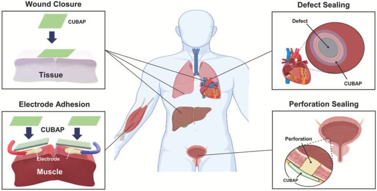 Иллюстрация потенциального применения биоадгезивного пластыря для внутренних органов