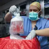 Медсестра извлекает почку свиньи из контейнера для подготовки к трансплантации