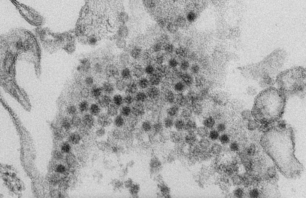 Энтеровирус D68 (EV-D68) под микроскопом / © CDC/ Cynthia S. Goldsmith, Yiting Zhang
