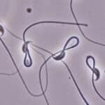 Воздействие даже низких доз микропластика ударило по качеству спермы