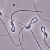 Сперматозоиды под микроскопом