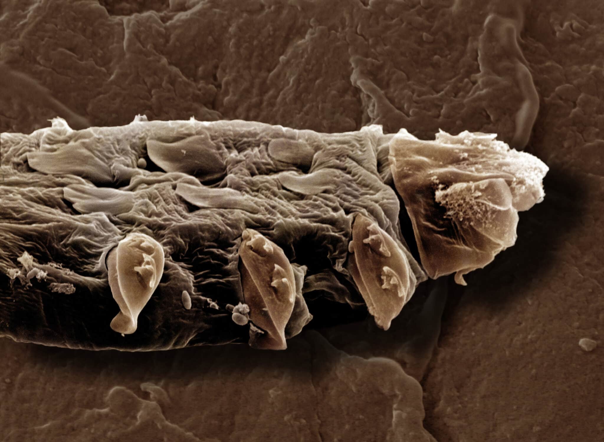 клещ Demodex