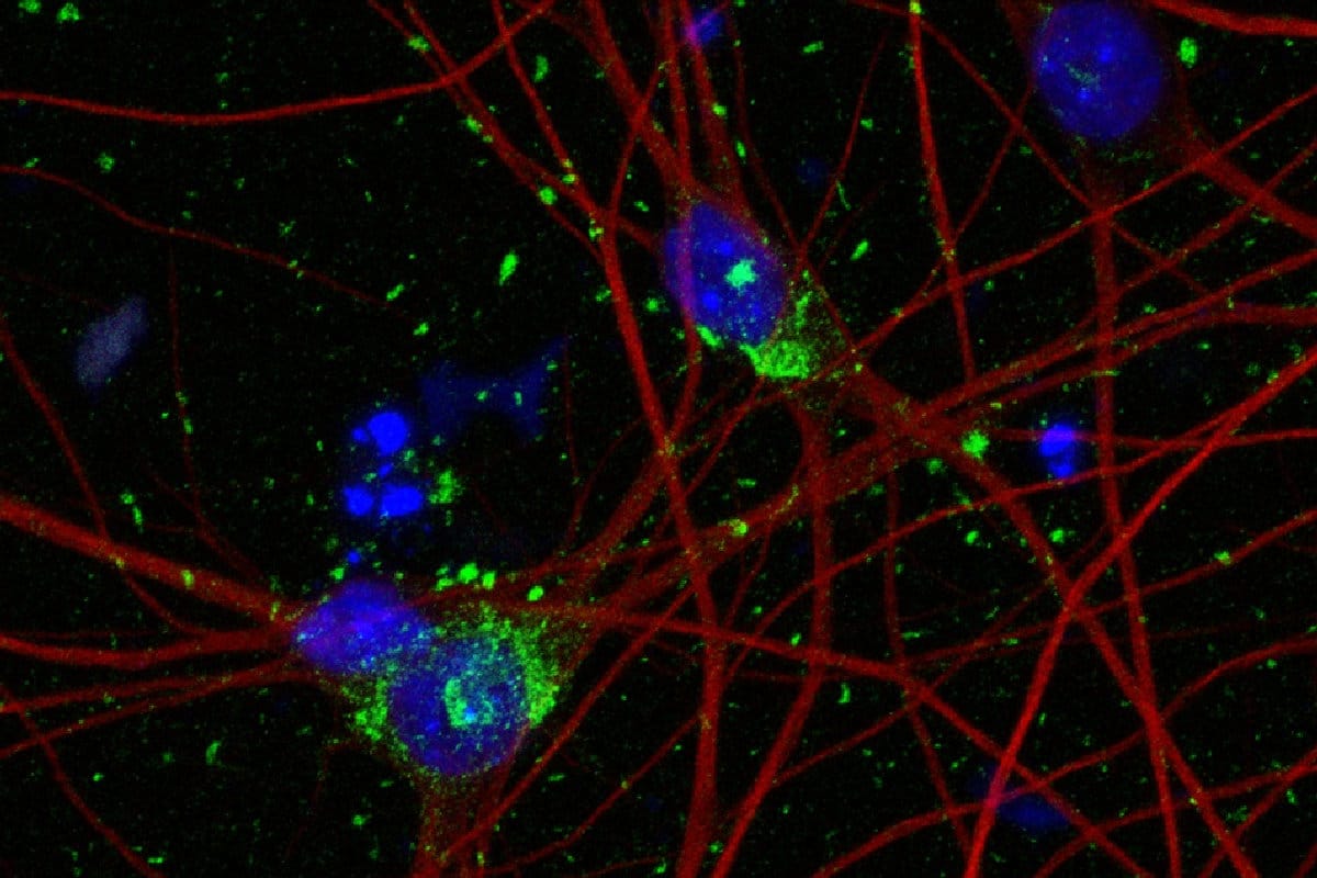 ГМО-нейроны для изучения таупатий