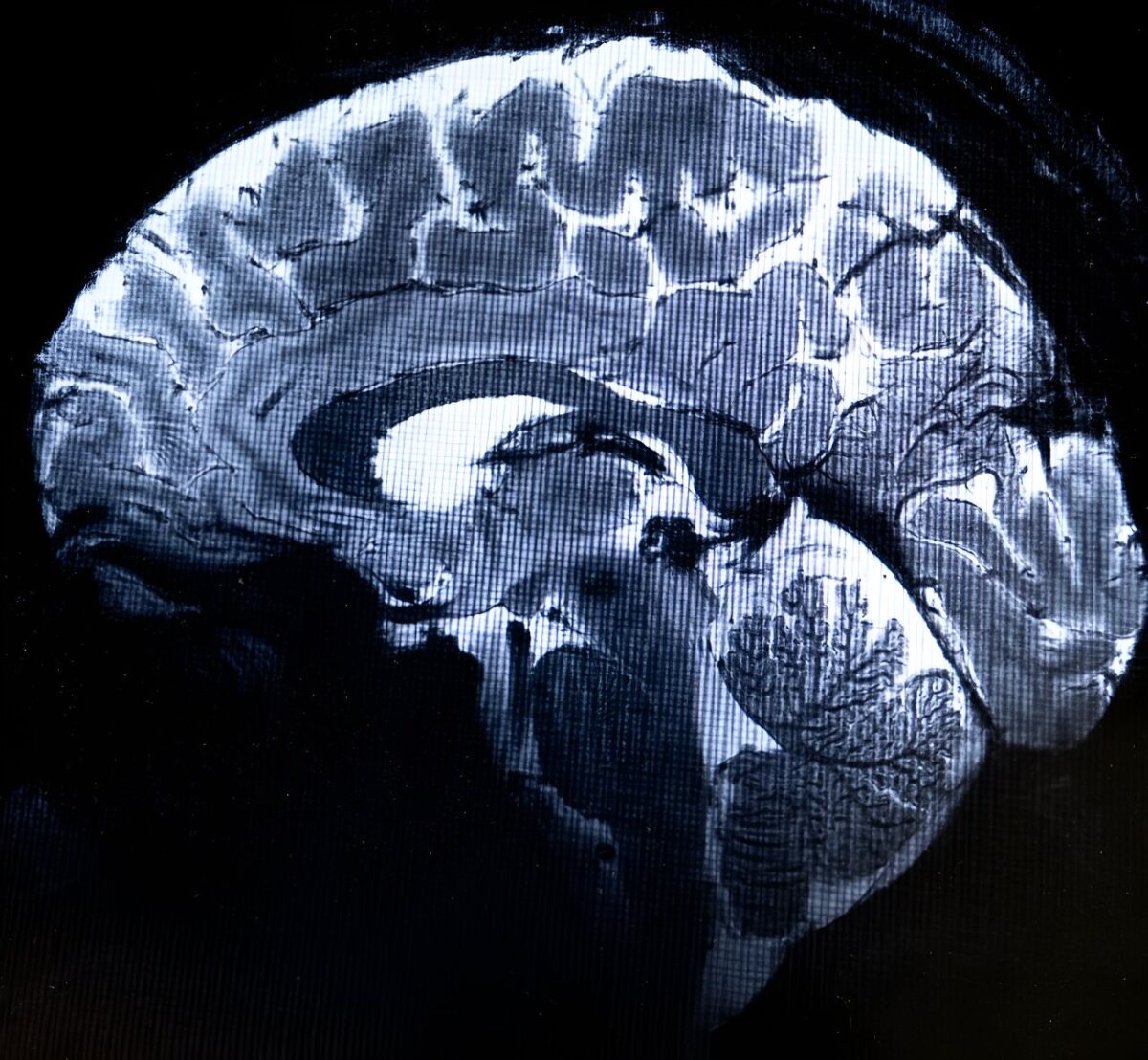 Изображение человеческого мозга, полученное МРТ / © AFP