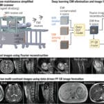 Создан прототип дешевого МРТ-сканера с питанием от розетки
