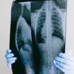 Ученые Пермского Политеха рассказали, какие болезни выявляют рентген, КТ и МРТ