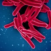 Возбудитель туберкулеза Mycobacterium tuberculosis