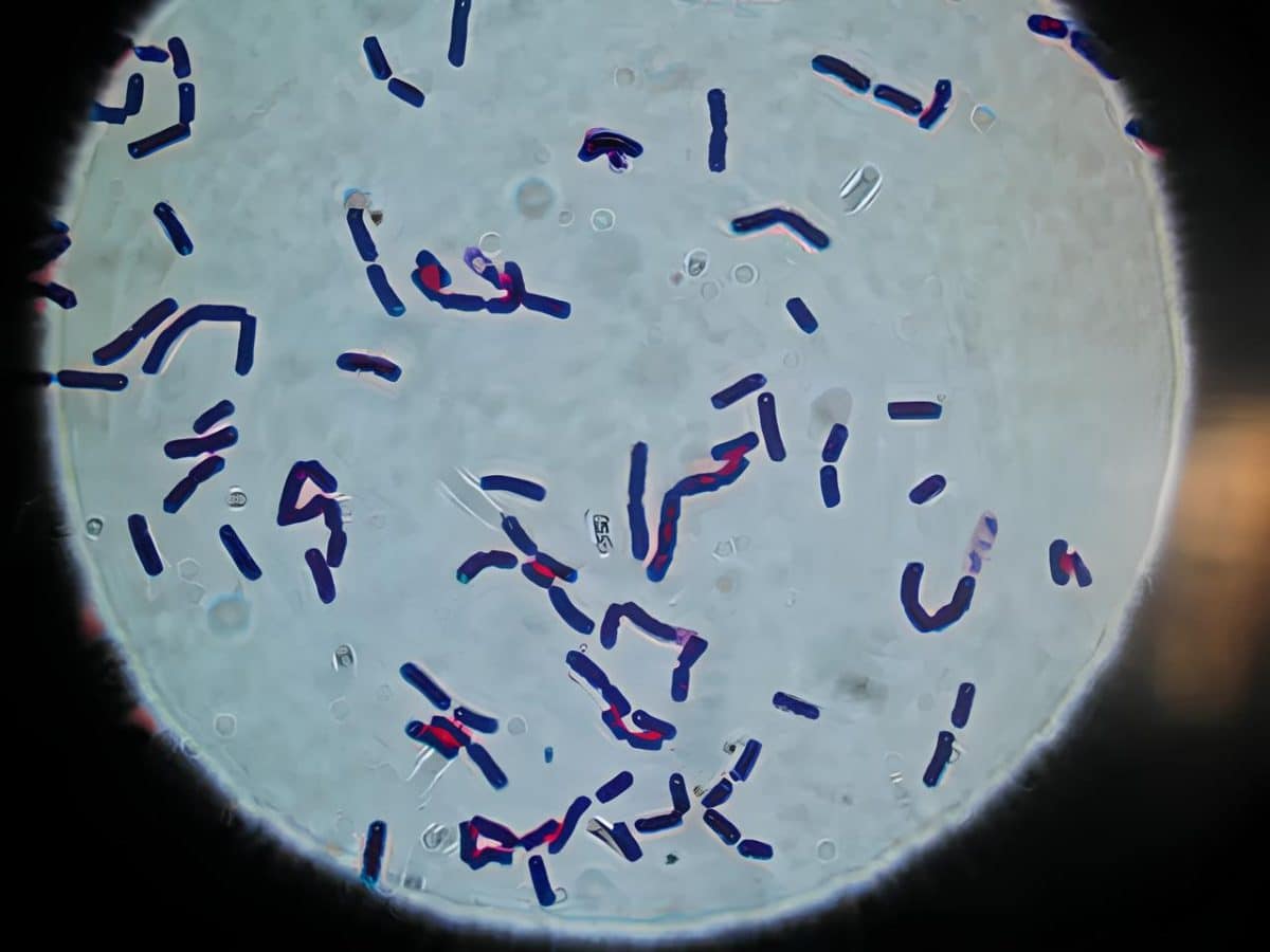 Bacillus cereus