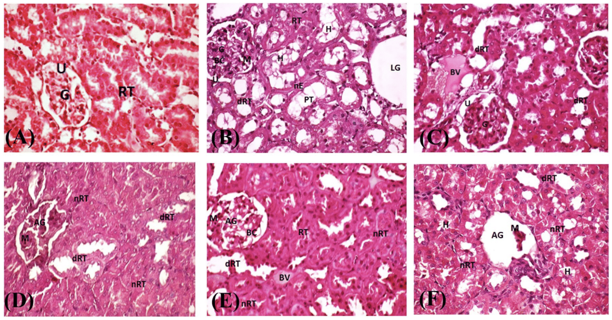 Микроскопические фотографии тканей почек каждой из групп эксперимента / © Nature