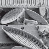 Сканирующая электронная микроскопия клеток Nitzschia amphibia var. padana
