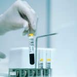 Медики оценили вероятность смерти по тесту на толерантность к глюкозе