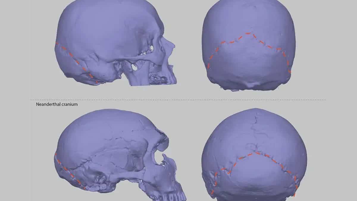 «‎Неандертальский череп» стал причиной головной боли у некоторых современных людей